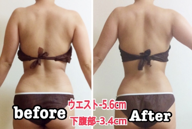 美体造形®筋膜リリース施術前後の比較